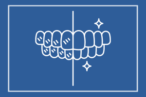 teeth whitening