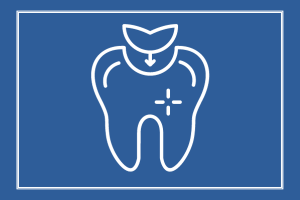 tooth fillings