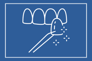 dental teeth veneers